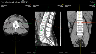 Smart radiology