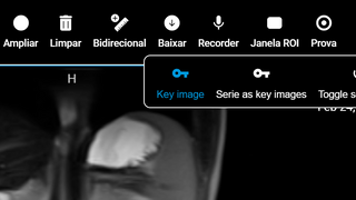 Smart radiology